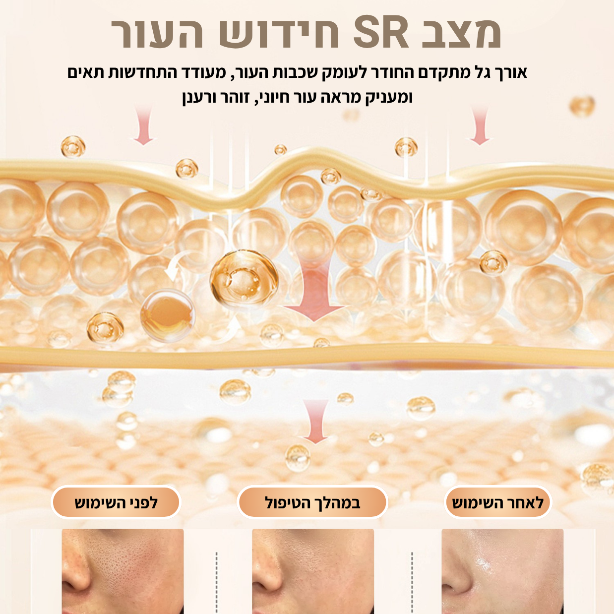 Myvane ICE Pro: מכשיר IPL ביתי 3 ב-1 להסרת שיער וטיפוח העור – תמונה 9