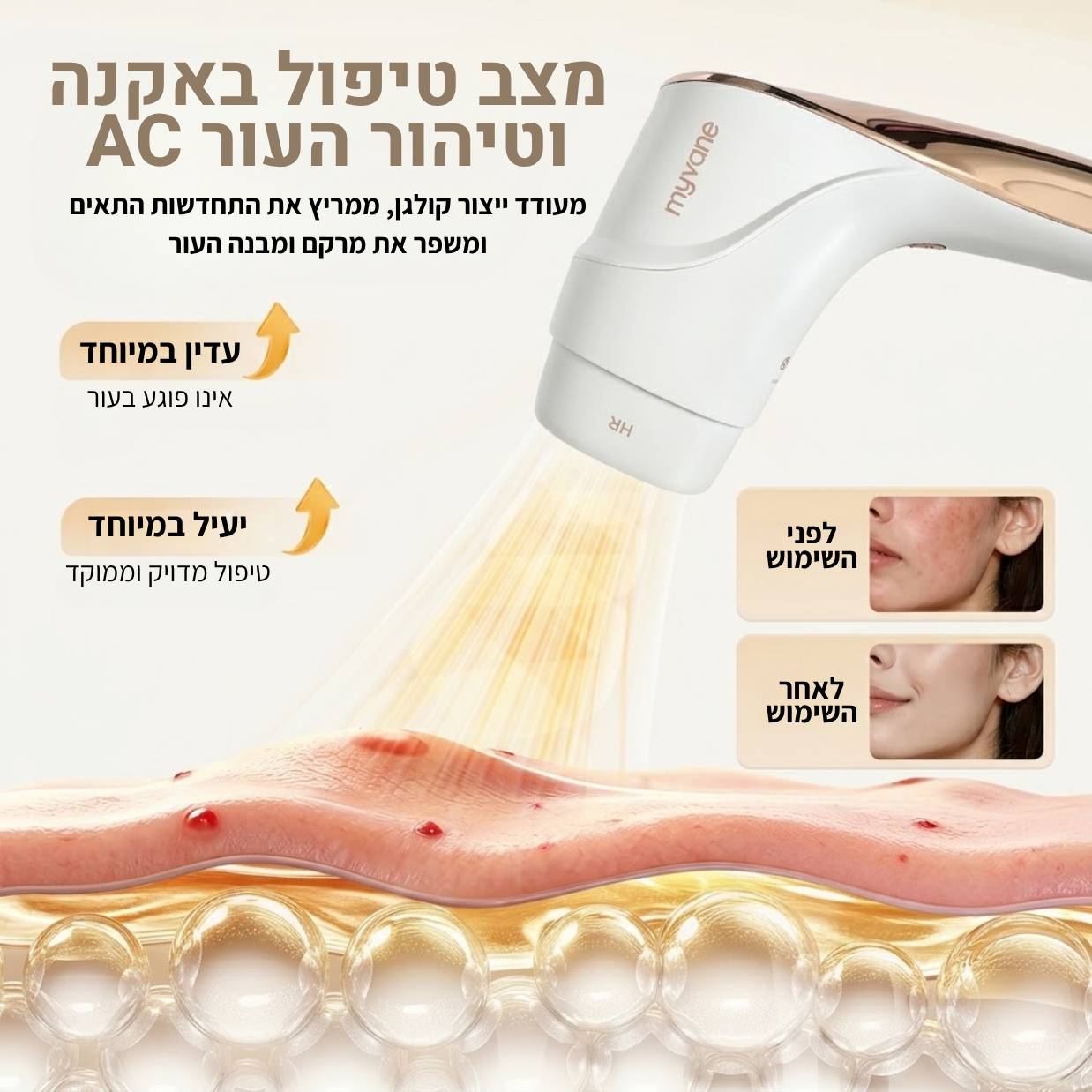 Myvane ICE Pro: מכשיר IPL ביתי 3 ב-1 להסרת שיער וטיפוח העור – תמונה 8